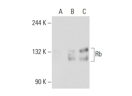  Rb (C-15): sc-50. Western blot analysis of Rb expression in non-transfected 293T: sc-117752 (A), human Rb transfected 293T: sc-159907 (B) and K-562 (C) whole cell lysates.