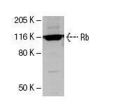  Rb (C-15): sc-50. Western blot analysis of Rb expression in K-562 whole cell lysate.