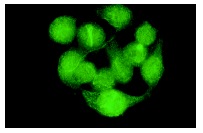  Rb (M-15): sc-1538. Immunofluorescence staining of methanol-fixed HeLa cells showing nuclear localization.