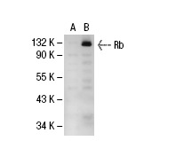  Rb (M-15): sc-1538. Western blot analysis of Rb expression in non-transfected: sc-117752 (A) and human Rb transfected: sc-114014 (B) 293T whole cell lysates.