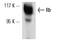  Rb (M-153): sc-7905. Western blot analysis of Rb expression in A-431 nuclear extract.