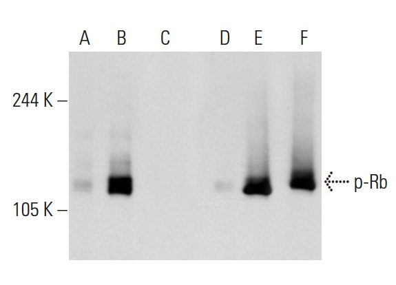  Western blot analysis of Rb phosphorylation in non-transfected: sc-117752 (A,D), untreated human Rb transfected: sc-114014 (B,E) and lambda protein phosphatase treated human Rb transfected: sc-114014 (C,F) 293T whole cell lysates. Antibodies tested include p-Rb (Ser 780)-R: sc-12901-R (A,B,C) and Rb (M-153): sc-7905 (D,E,F).