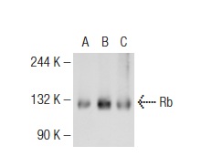  Rb (M-153): sc-7905. Western blot analysis of Rb expression in non-transfected 293T: sc-117752 (A), human Rb transfected 293T: sc-159907 (B) and K-562 (C) whole cell lysates.