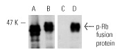  Western blot analysis of mouse recombinant Rb fusion protein (A,C) and Rb phosphorylated by human recombinant Cdc2 complexed with human recombinant Cyclin B (B,D). Antibodies tested include Rb (M-153): sc-7905 (A,B) and p-Rb (Ser 795)-R: sc-7986-R (C,D).