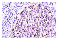  Rb (M-153): sc-7905. Immunoperoxidase staining of formalin-fixed, paraffin-embedded human tonsil tissue showing nuclear localization.