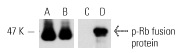  Western blot analysis of non-phosphorylated (A,C) and ERK 2-phosphorylated (B,D) mouse recombinant Rb fusion protein. Antibodies tested include Rb (M-153): sc-7905 (A,B) and p-Rb (Ser 780)-R: sc-12901-R (C,D).