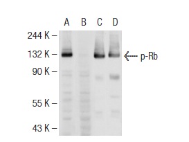  Western blot analysis of Rb phosphorylation in untreated (A,C) and lambda protein phosphatase treated (B,D) MOLT-4 whole cell lysates. Antibodies tested include p-Rb (78.T821/826): sc-135776 (A,B) and Rb (M-153): sc-7905 (C,D).