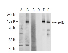  Western blot analysis of Rb phosphorylation in non-transfected: sc-117752 (A,D), untreated human Rb transfected: sc-114014 (B,E) and lambda protein phosphatase treated human Rb transfected: sc-114014 (C,F) 293T whole cell lysates. Antibodies tested include p-Rb (83.T821/826): sc-135777 (A,B,C) and Rb (M-153): sc-7905 (D,E,F). 