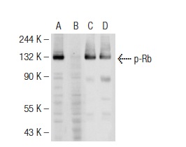  Western blot analysis of Rb phosphorylation in untreated (A,C) and lambda protein phosphatase treated (B,D) MOLT-4 whole cell lysates. Antibodies tested include p-Rb (83.T821/826): sc-135774 (A,B) and Rb (M-153): sc-7905 (C,D).