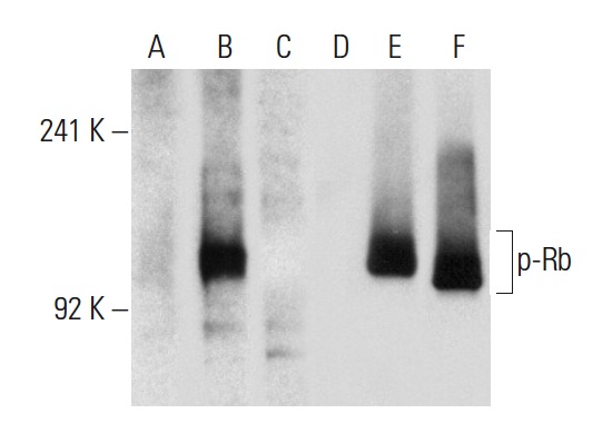  Western blot analysis of Rb phosphorylation in non-transfected: sc-117752 (A,D), untreated human Rb transfected: sc-114014 (B,E) and lambda protein phosphatase (sc-200312A) treated human Rb transfected: sc-114014 (C,F) 293T whole cell lysates. Antibodies tested include p-Rb (E-10): sc-271930 (A,B,C) and Rb (M-153): sc-7905 (D,E,F).