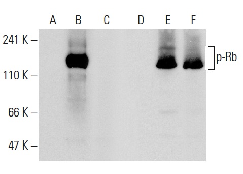  Western blot analysis of Rb phosphorylation in non-transfected: sc-117752 (A,D), untreated human Rb transfected: sc-114014 (B,E) and lambda protein phosphatase (sc-200312A) treated human Rb transfected: sc-114014 (C,F) 293T whole cell lysates. Antibodies tested include p-Rb (Thr 356)-R: sc-16837-R (A,B,C) and Rb (M-153): sc-7905 (D,E,F).