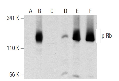  Western blot analysis of Rb phosphorylation in non-transfected: sc-117752 (A,D), untreated human Rb transfected: sc-114014 (B,E) and lambda protein phosphatase (sc-200312A) treated human Rb transfected: sc-114014 (C,F) 293T whole cell lysates. Antibodies tested include p-Rb (Thr 356)-R: sc-16837-R (A,B,C) and Rb (M-153): sc-7905 (D,E,F).