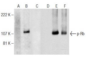  Western blot analysis of Rb phosphorylation in non-transfected: sc-117752 (A,D), untreated human Rb transfected: sc-114014 (B,E) and lambda protein phosphatase (sc-200312A) treated human Rb transfected: sc-114014 (C,F) 293T whole cell lysates. Antibodies tested include p-Rb (A-3): sc-377516 (A,B,C) and Rb (M-153): sc-7905 (D,E,F).