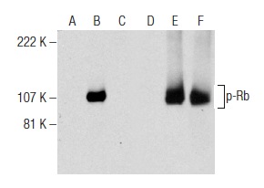  Western blot analysis of Rb phosphorylation in non-transfected: sc-117752 (A,D), untreated human Rb transfected: sc-114014 (B,E) and lambda protein phosphatase (sc-200312A) treated human Rb transfected: sc-114014 (C,F) 293T whole cell lysates. Antibodies tested include p-Rb (B-7): sc-377527 (A,B,C) and Rb (M-153): sc-7905 (D,E,F).