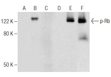  Western blot analysis of Rb phosphorylation in non-transfected: sc-117752 (A,D), untreated human Rb transfected: sc-114014 (B,E) and lambda protein phosphatase (sc-200312A) treated human Rb transfected: sc-114014 (C,F) 293T whole cell lysates. Antibodies tested include p-Rb (F-2): sc-377539 (A,B,C) and Rb (M-153): sc-7905 (D,E,F).