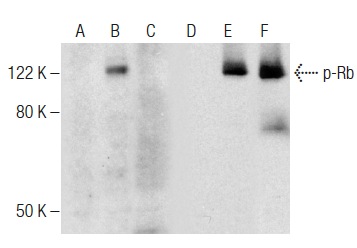  Western blot analysis of Rb phosphorylation in non-transfected: sc-117752 (A,D), untreated human Rb transfected: sc-114014 (B,E) and lambda protein phosphatase (sc-200312A) treated human Rb transfected: sc-114014 (C,F) 293T whole cell lysates. Antibodies tested include p-Rb (F-4): sc-377540 (A,B,C) and Rb (M-153): sc-7905 (D,E,F).