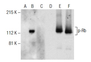  Western blot analysis of Rb phosphorylation in non-transfected: sc-117752 (A,D), untreated human Rb transfected: sc-114014 (B,E) and lambda protein phosphatase (sc-200312A) treated human Rb transfected: sc-114014 (C,F) 293T whole cell lysates. Antibodies tested include p-Rb (B-8): sc-377541 (A,B,C) and Rb (M-153): sc-7905 (D,E,F).