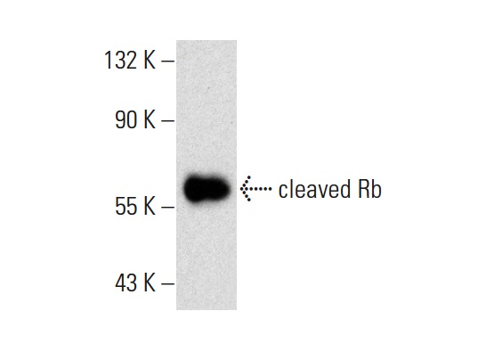  cleaved Rb (172C1094): sc-56217. Western blot analysis of cleaved Rb expression in K-562 whole cell lysate.