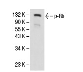  p-Rb (51B7): sc-56174. Western blot analysis of phosphorylated Rb expression in K-562 whole cell lysate.