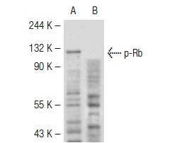  p-Rb (ser608) (51B7): sc-56174. Western blot analysis of Rb phosphorylation in untreated (A) and lambda protein phosphatase treated (B) SK-LMS-1 whole cell lysates.