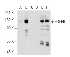  Western blot analysis of Rb phosphorylation in non-transfected: sc-117752 (A, D), untreated human Rb transfected: sc-114014 (B, E) and lambda protein phosphatase treated human Rb transfected: sc-114014 (C, F) 293T whole cell lysates.  Antibodies tested include p-Rb (ser608) (51B7): sc-56174 (A, B, C) and Rb (M-153): sc-7905 (D, E, F).