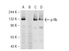  Western blot analysis of Rb phosphorylation in untreated (A,C) and lambda protein phosphatase treated (B,D) MOLT-4 whole cell lysates. Antibodies tested include p-Rb (78.T821/826): sc-135776 (A,B) and Rb (M-153): sc-7905 (C,D).