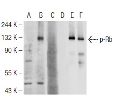  Western blot analysis of Rb phosphorylation in non-transfected: sc-117752 (A,D), untreated human Rb transfected: sc-114014 (B,E) and lambda protein phosphatase treated human Rb transfected: sc-114014 (C,F) 293T whole cell lysates. Antibodies tested include p-Rb (83.T821/826): sc-135777 (A,B,C) and Rb (M-153): sc-7905 (D,E,F). 