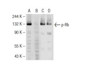  Western blot analysis of Rb phosphorylation in untreated (A,C) and lambda protein phosphatase treated (B,D) MOLT-4 whole cell lysates. Antibodies tested include p-Rb (83.T821/826): sc-135774 (A,B) and Rb (M-153): sc-7905 (C,D).