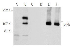  Western blot analysis of Rb phosphorylation in non-transfected: sc-117752 (A,D), untreated human Rb transfected: sc-114014 (B,E) and lambda protein phosphatase (sc-200312A) treated human Rb transfected: sc-114014 (C,F) 293T whole cell lysates. Antibodies tested include p-Rb (A-5): sc-377528 (A,B,C) and Rb (M-153): sc-7905 (D,E,F).