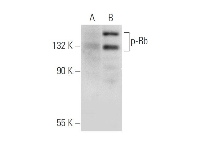  p-Rb (B-4): sc-514031. Western blot analysis of Rb phosphorylation expression in MOLT-4 (A) and forskolin treated MOLT-4 (B) whole cell lysates.