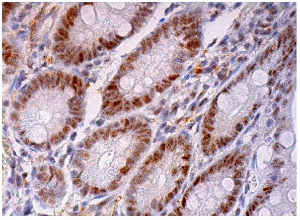  p-Rb (B-8): sc-377541. Immunoperoxidase staining of formalin fixed, paraffin-embedded human duodenum tissue showing nuclear staining of glandular cells.