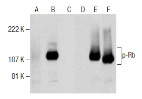  Western blot analysis of Rb phosphorylation in non-transfected: sc-117752 (A,D), untreated human Rb transfected: sc-114014 (B,E) and lambda protein phosphatase (sc-200312A) treated human Rb transfected: sc-114014 (C,F) 293T whole cell lysates. Antibodies tested include p-Rb (C-3): sc-377524 (A,B,C) and Rb (M-153): sc-7905 (D,E,F).