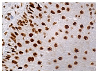  p-Rb (E-10): sc-271930. Immunoperoxidase staining of formalin fixed, paraffin-embedded human oral mucosa tissue showing nuclear staining of squamous epithelial cells.