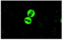  p-Rb (Ser 249/Thr 252): sc-16671. Immunofluorescence staining of methanol-fixed NIH/3T3 cells showing nuclear localization.