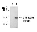  p-Rb (Ser 249/Thr 252): sc-16671. Western blot analysis of untreated (A) and Cdc-2-treated (B) mouse recombinant Rb fusion protein fragment showing Rb phosphorylation.