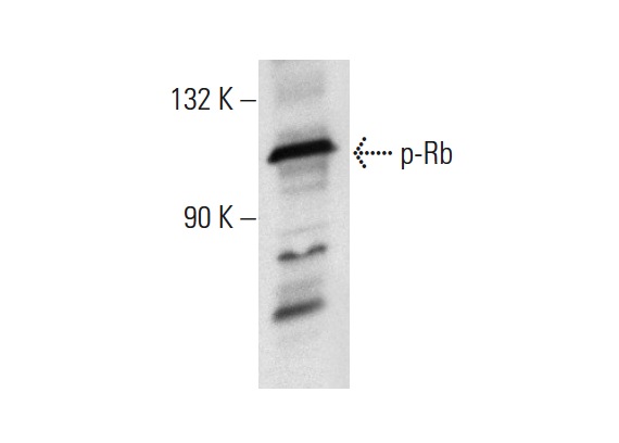  p-Rb (Ser 249/Thr 252): sc-16671. Western blot analysis of Rb phosphorylation in K-562 whole cell lysate.