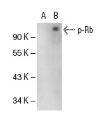  p-Rb (Ser 780): sc-12901. Western blot analysis of Rb phosphorylation in non-transfected: sc-117752 (A) and human Rb transfected: sc-114014 (B) 293T whole cell lysates.