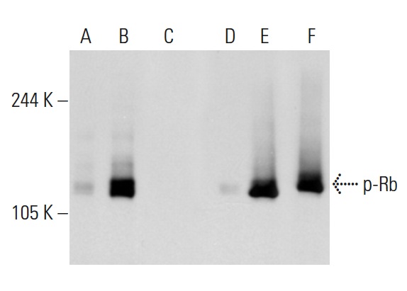  Western blot analysis of Rb phosphorylation in non-transfected: sc-117752 (A,D), untreated human Rb transfected: sc-114014 (B,E) and lambda protein phosphatase treated human Rb transfected: sc-114014 (C,F) 293T whole cell lysates. Antibodies tested include p-Rb (Ser 780)-R: sc-12901-R (A,B,C) and Rb (M-153): sc-7905 (D,E,F).