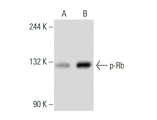  p-Rb (Ser 795)-R: sc-21875-R. Western blot analysis of Rb phosphorylation in non-transfected: sc-117752 (A) and human Rb transfected: sc-159907 (B) 293T whole cell lysates.