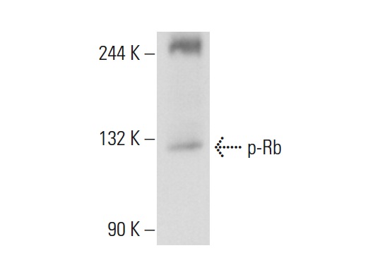  p-Rb (Ser 795)-R: sc-21875-R. Western blot analysis of Rb phosphorylation in K-562 whole cell lysate.