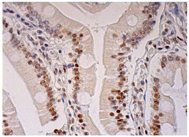  p-Rb (Ser 795): sc-21875. Immunoperoxidase staining of formalin fixed, paraffin-embedded human duodenum tissue showing nuclear staining of glandular cells.