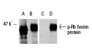  Western blot analysis of mouse recombinant Rb fusion protein (A,C) and Rb phosphorylated by human recombinant Cdc2 complexed with human recombinant Cyclin B (B,D). Antibodies tested include Rb (M-153): sc-7905 (A,B) and p-Rb (Ser 795)-R: sc-7986-R (C,D).