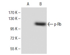  p-Rb (Ser 807): sc-293117. Western blot analysis of Rb phosphorylation expression in untreated (A) and UV treated (B) 3T3 whole cell lysates.