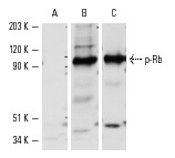  Western blot analysis of Rb phosphorylation in SK-LMS-1 whole cell lysate. Blots were probed with p-Rb (Ser 807/811)-R: sc-16670-R preincubated with cognate phosphorylated peptide (A) or unphosphorylated peptide (B) and Rb (IF8): sc-102 (C).