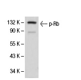  p-Rb (SPM441): sc-56450. Western blot analysis of phosphorylated Rb expression in K-562 whole cell lysate.