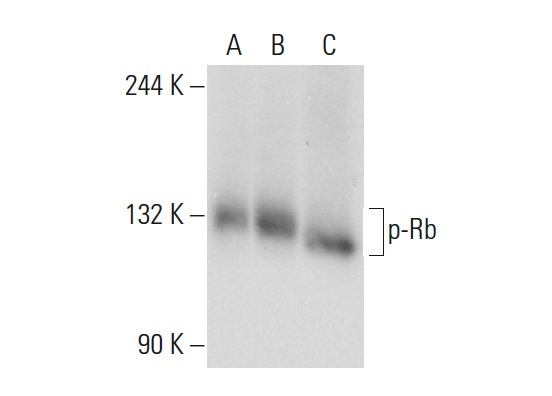  p-Rb (SPM441): sc-56450. Western blot analysis of Rb phosphorylation in non-transfected 293T: sc-117752 (A), human Rb transfected 293T: sc-159907 (B) and K-562 (C) whole cell lysates.