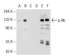  Western blot analysis of Rb phosphorylation in non-transfected: sc-117752 (A, D), untreated human Rb transfected: sc-114014 (B, E) and lambda protein phosphatase treated human Rb transfected: sc-114014 (C, F) 293T whole cell lysates.  Antibodies tested include p-Rb (SPM441): sc-56450 (A, B, C) and Rb (M-153): sc-7905 (D, E, F).