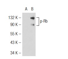  p-Rb (Thr 356)-R: sc-16837-R. Western blot analysis of Rb phosphorylation expression in non-transfected: sc-117752 (A) and human Rb transfected: sc-114014 (B) 293T whole cell lysates.