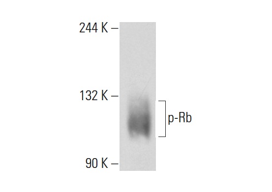  p-Rb (Ser 356)-R: sc-16837-R. Western blot analysis of Rb phosphorylation in K-562 whole cell lysate.