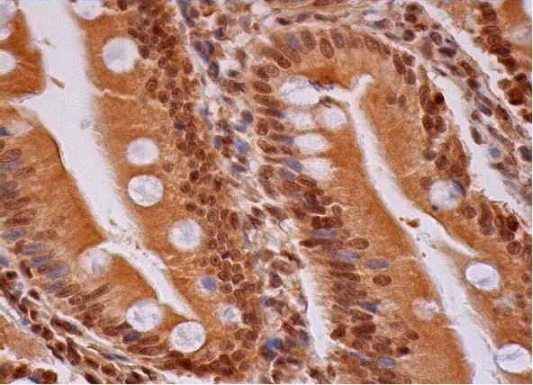  p-Rb (Thr 356)-R: sc-16837-R. Immunoperoxidase staining of formalin fixed, paraffin-embedded human duodenum tissue showing nuclear and cytoplasmic staining of glandular cells.